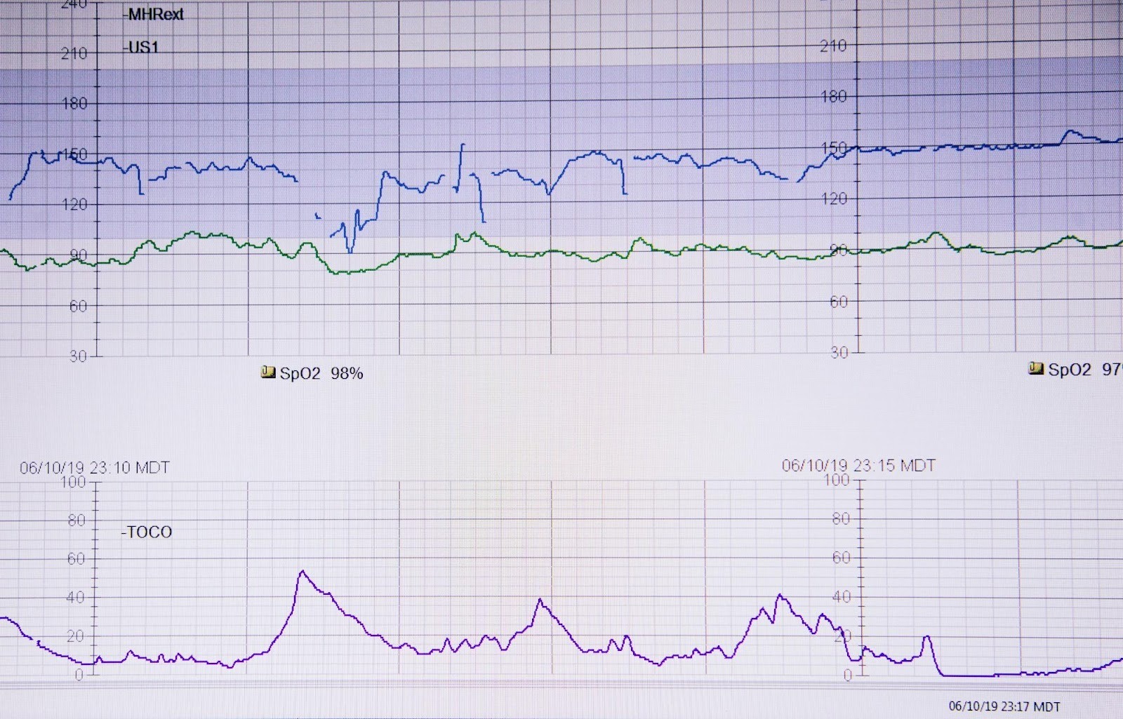 Medical monitor graph displaying vitals, symbolizing the importance of tracking website health metrics and SEO performance data.