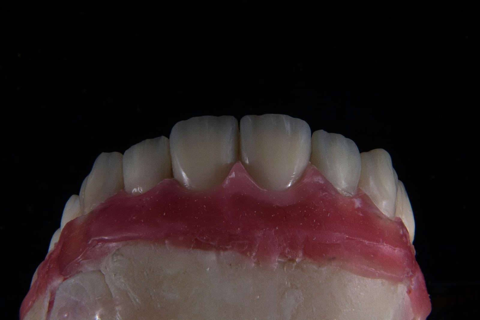 Close-up of a dental prosthetic on a black background, used to showcase cosmetic dentistry results in a marketing portfolio.